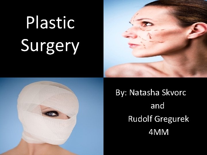Plastic Surgery By: Natasha Skvorc and Rudolf Gregurek 4 MM 