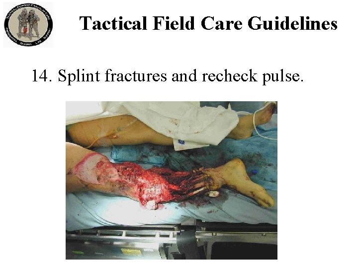 Tactical Field Care Guidelines 14. Splint fractures and recheck pulse. 