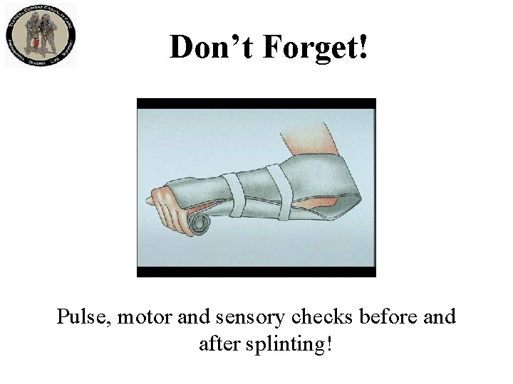 Don’t Forget! Pulse, motor and sensory checks before and after splinting! 