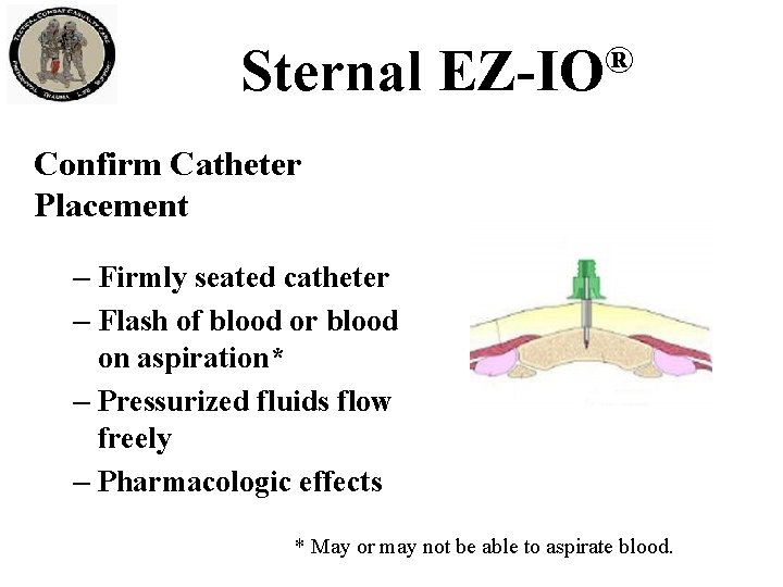 Sternal ® EZ-IO Confirm Catheter Placement – Firmly seated catheter – Flash of blood