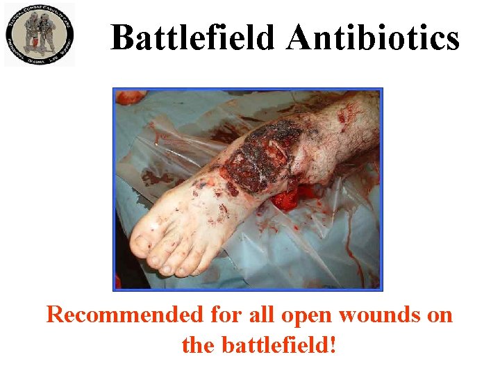 Battlefield Antibiotics Recommended for all open wounds on the battlefield! 