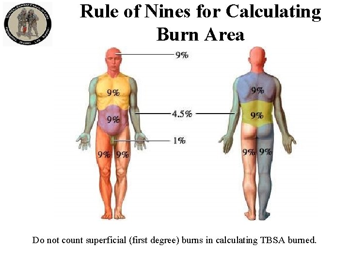 Rule of Nines for Calculating Burn Area Do not count superficial (first degree) burns