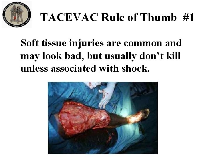 TACEVAC Rule of Thumb #1 Soft tissue injuries are common and may look bad,