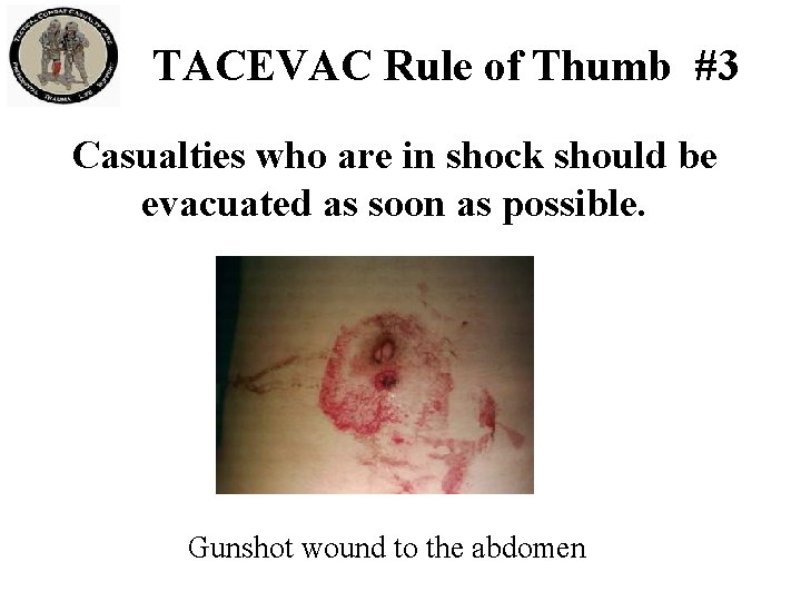 TACEVAC Rule of Thumb #3 Casualties who are in shock should be evacuated as