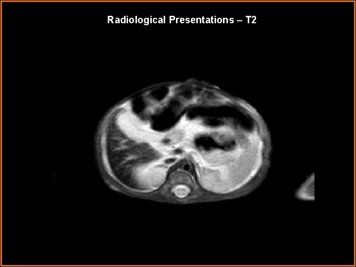 Radiological Presentations – T 2 