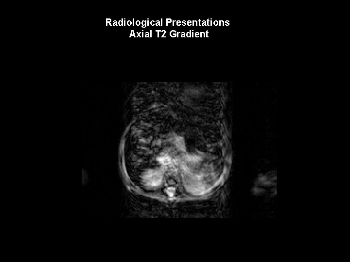 Radiological Presentations Axial T 2 Gradient TR 2500 TE 6 TE 9 TE 15
