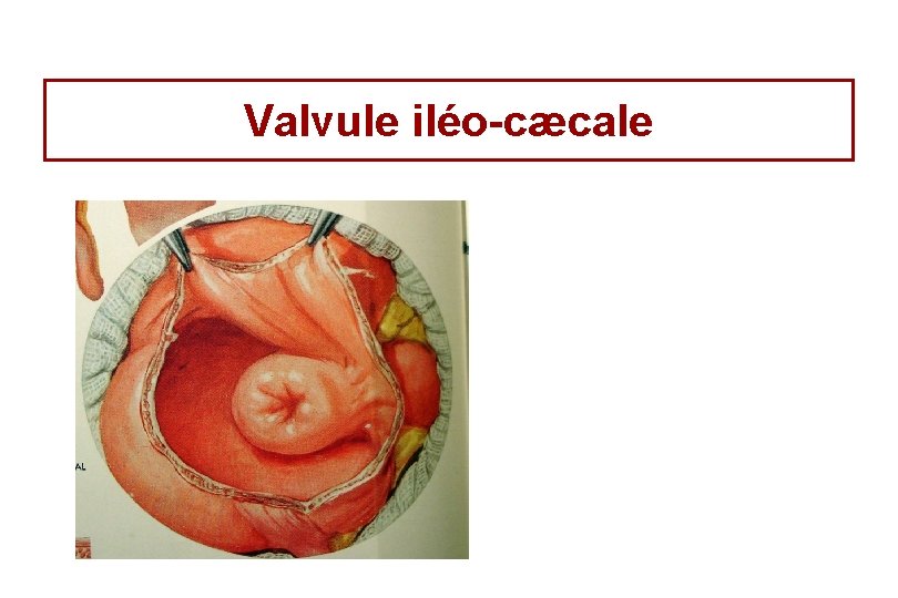 Valvule iléo-cæcale Valvule iléo-cæcale