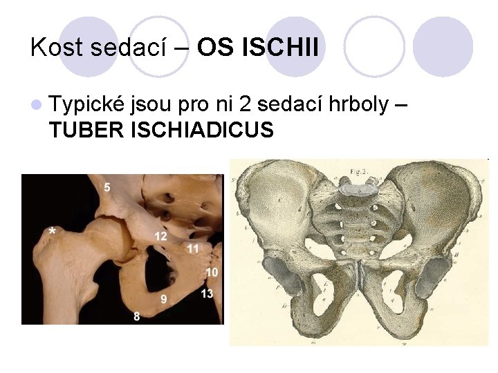 Kost sedací – OS ISCHII l Typické jsou pro ni 2 sedací hrboly –