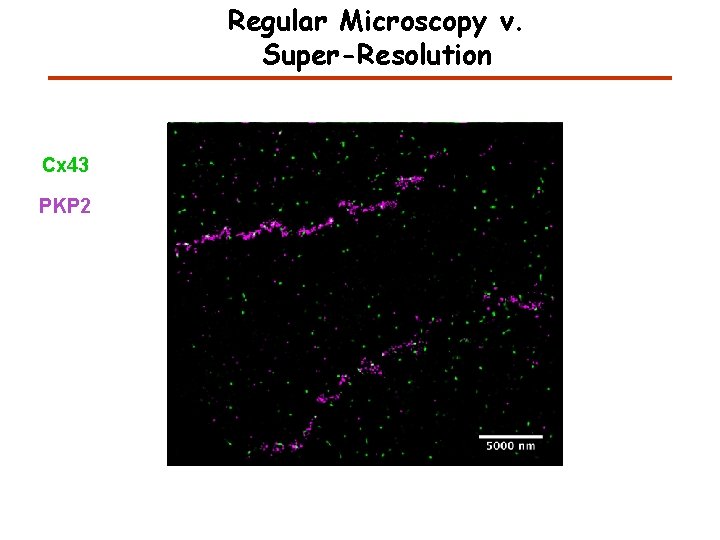 Regular Microscopy v. Super-Resolution Cx 43 PKP 2 