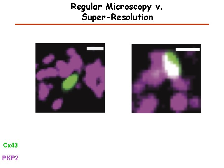 Regular Microscopy v. Super-Resolution Cx 43 PKP 2 