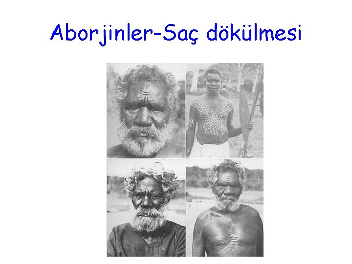 Aborjinler-Saç dökülmesi 