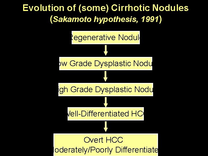 Evolution of (some) Cirrhotic Nodules (Sakamoto hypothesis, 1991) Regenerative Nodule Low Grade Dysplastic Nodule