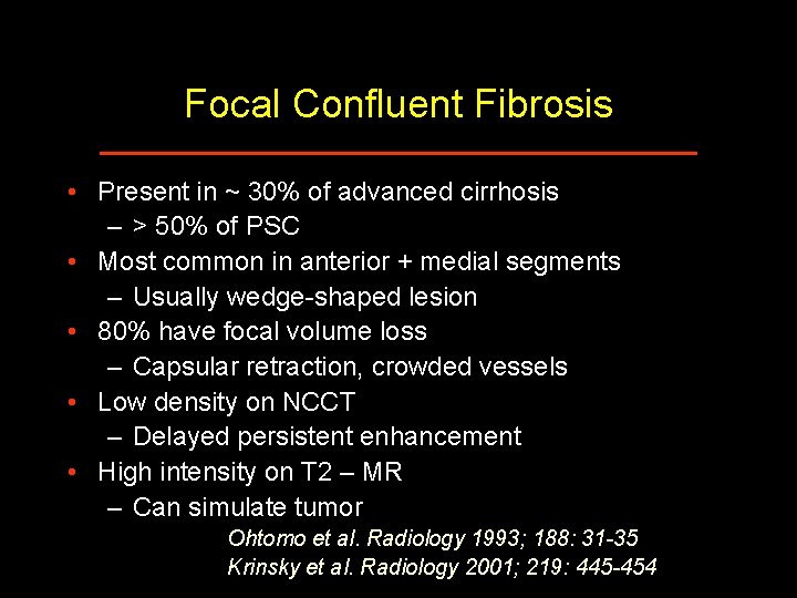 Focal Confluent Fibrosis • Present in ~ 30% of advanced cirrhosis – > 50%