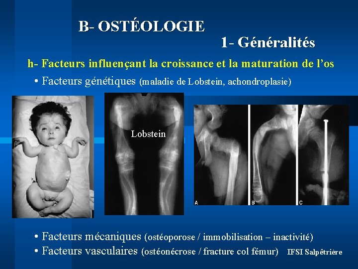 B- OSTÉOLOGIE 1 - Généralités h- Facteurs influençant la croissance et la maturation de