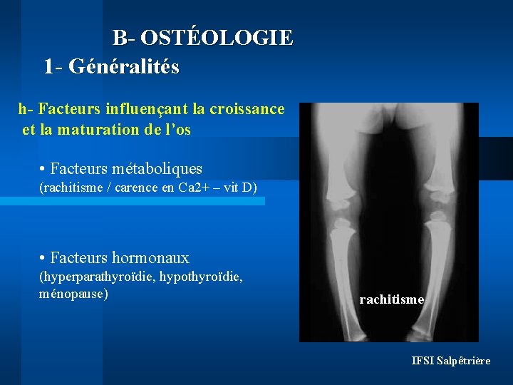 B- OSTÉOLOGIE 1 - Généralités h- Facteurs influençant la croissance et la maturation de B- OSTÉOLOGIE 1 - Généralités h- Facteurs influençant la croissance et la maturation de