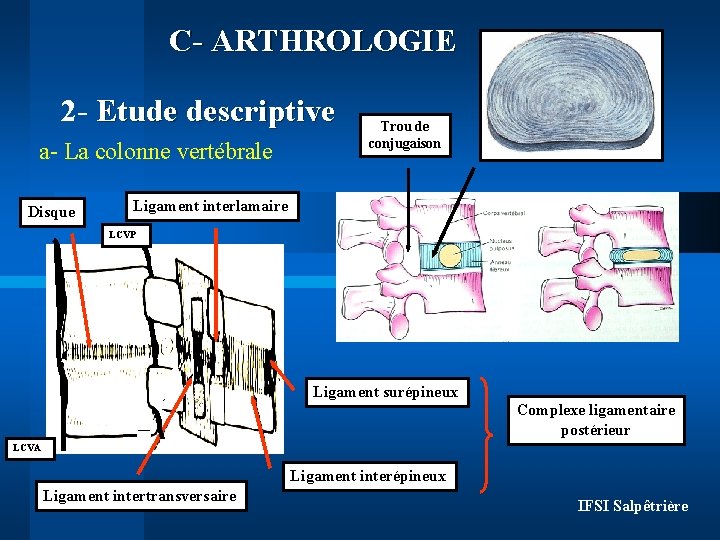 C- ARTHROLOGIE 2 - Etude descriptive a- La colonne vertébrale Disque Trou de conjugaison