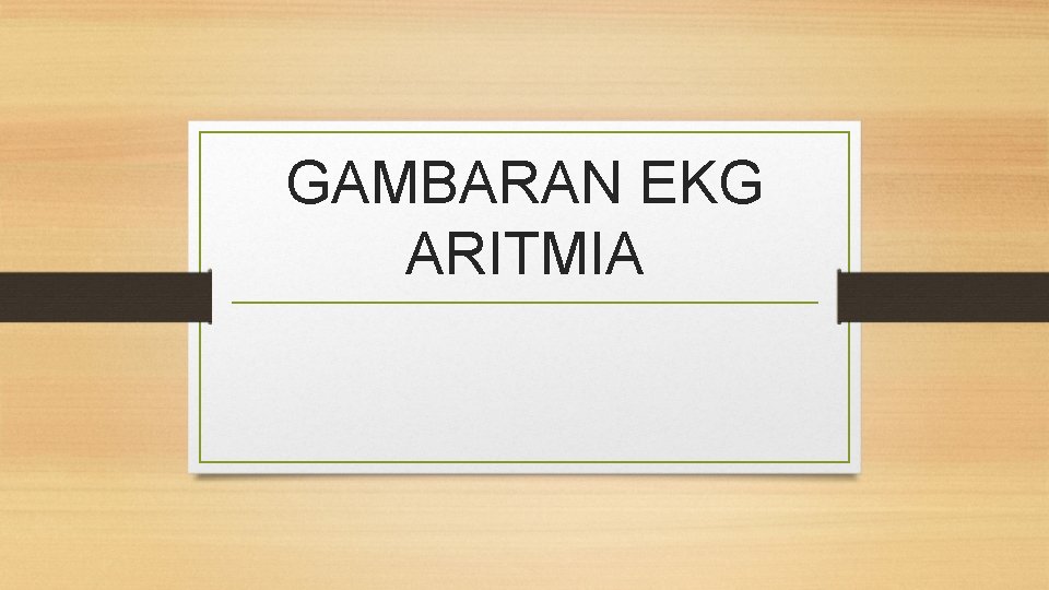 GAMBARAN EKG ARITMIA 