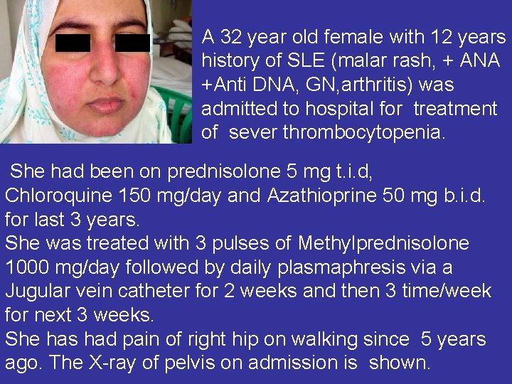 A 32 year old female with 12 years history of SLE (malar rash, +