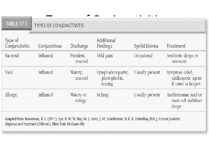 Types of Conjunctivitis Adapted from Braverman, R. S. (2011). Eye. In W. W. Hay,