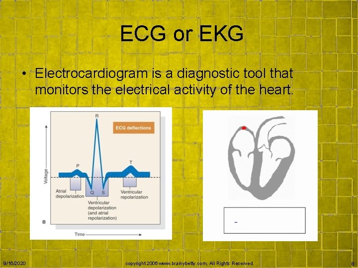 ECG or EKG • Electrocardiogram is a diagnostic tool that monitors the electrical activity