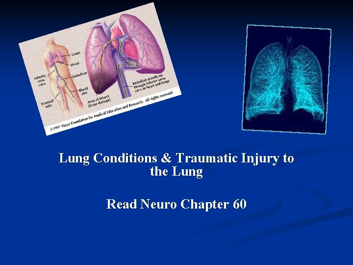 Lung Conditions & Traumatic Injury to the Lung Read Neuro Chapter 60 