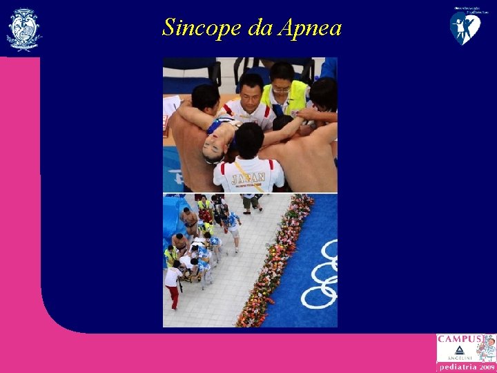 Sincope da Apnea 