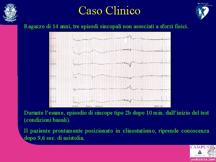 Caso Clinico Ragazzo di 14 anni, tre episodi sincopali non associati a sforzi fisici.