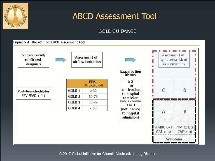 GOLD GUIDANCE 