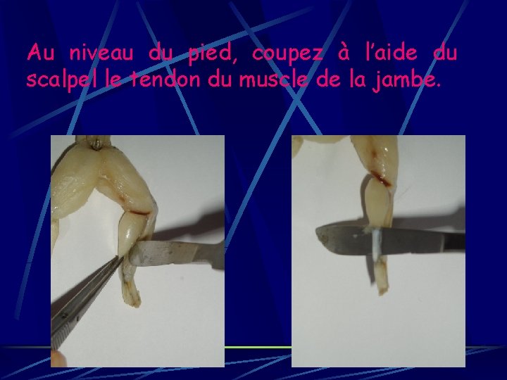 Au niveau du pied, coupez à l’aide du scalpel le tendon du muscle de