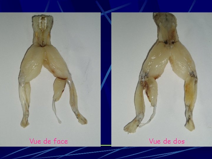 Vue de face Vue de dos 