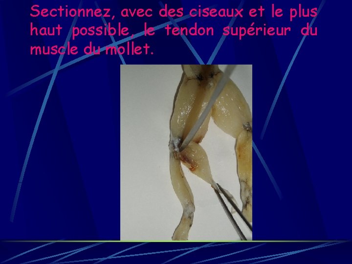 Sectionnez, avec des ciseaux et le plus haut possible, le tendon supérieur du muscle