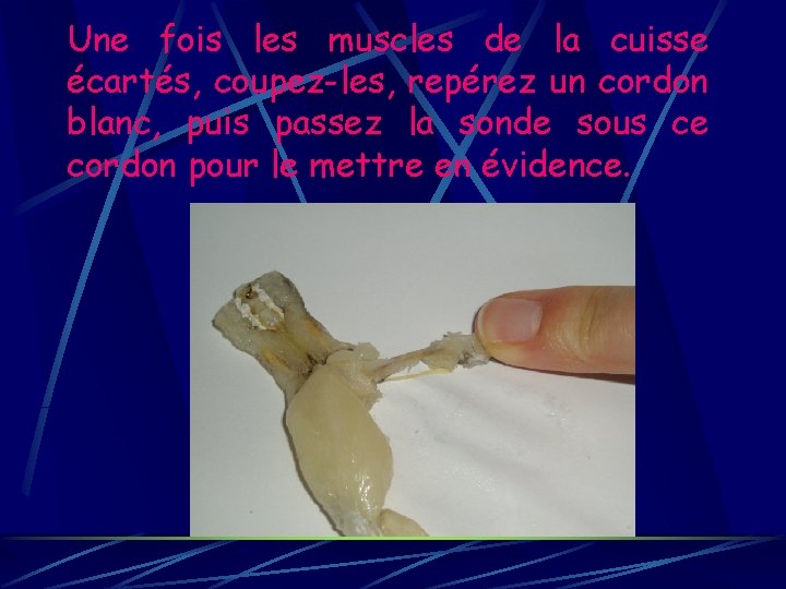 Une fois les muscles de la cuisse écartés, coupez-les, repérez un cordon blanc, puis