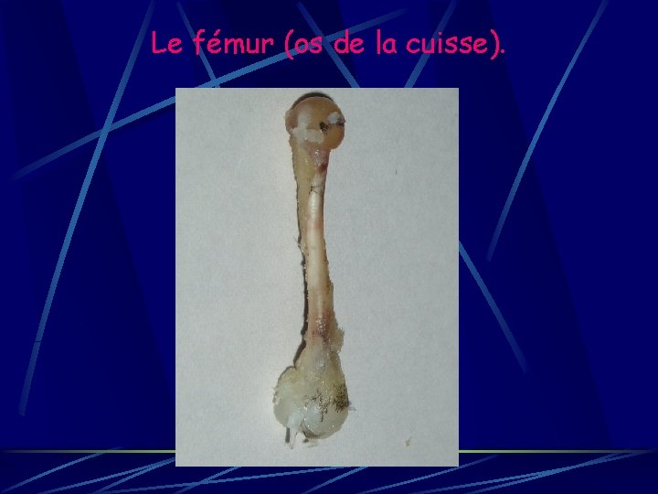 Le fémur (os de la cuisse). 