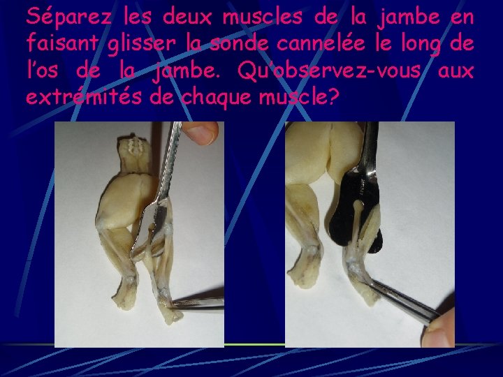 Séparez les deux muscles de la jambe en faisant glisser la sonde cannelée le