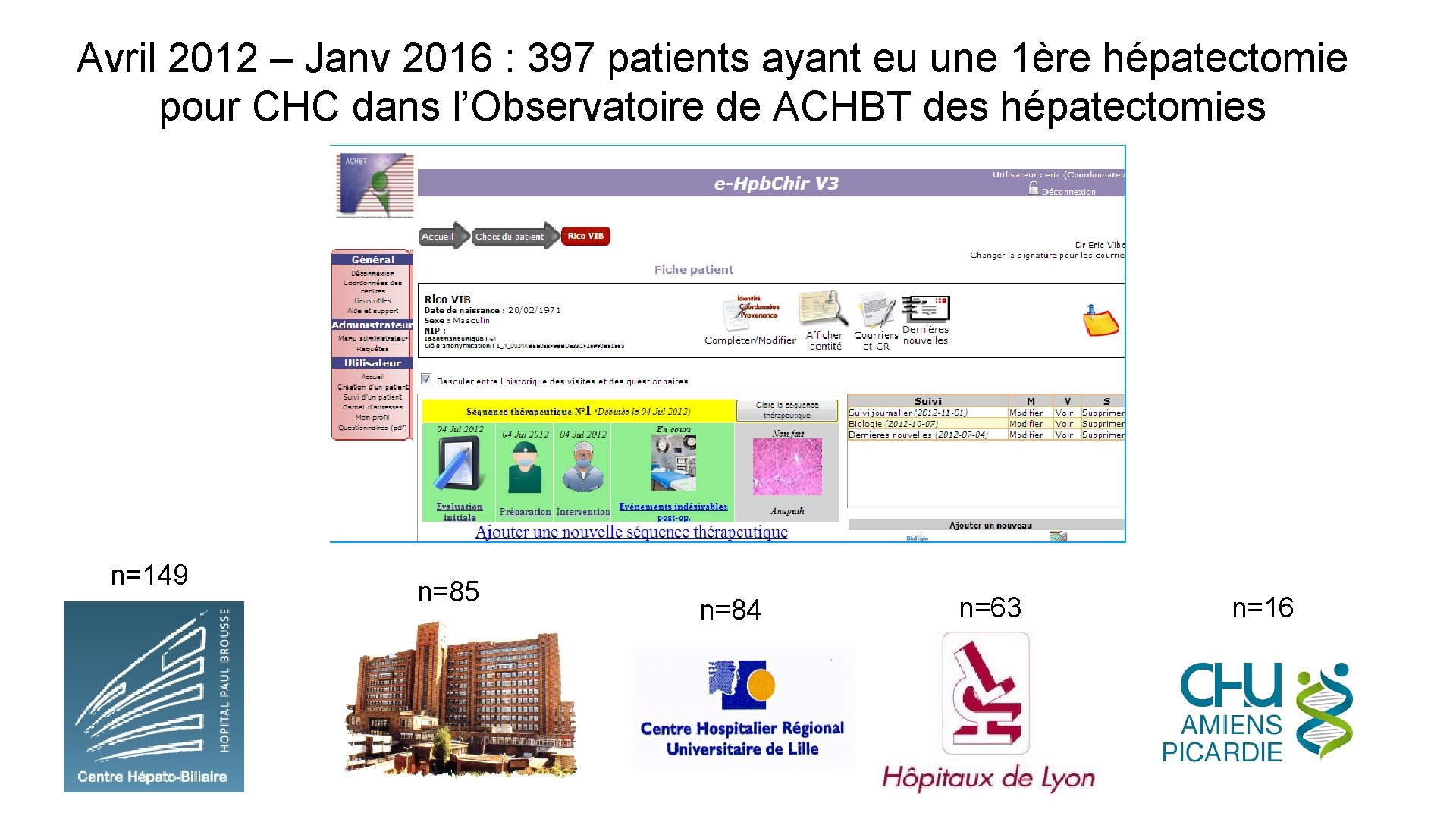 Avril 2012 – Janv 2016 : 397 patients ayant eu une 1ère hépatectomie pour