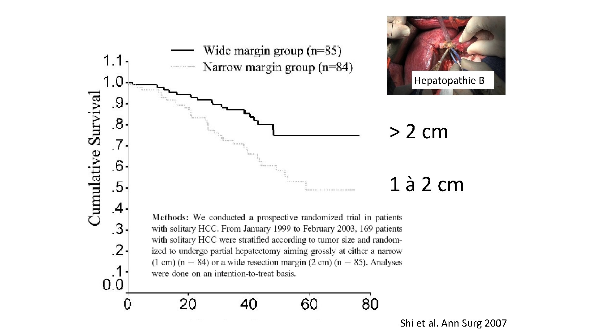 Hepatopathie B > 2 cm 1 à 2 cm Shi et al. Ann Surg