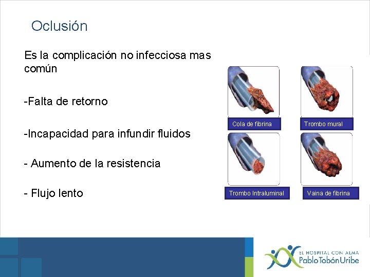 Oclusión Es la complicación no infecciosa mas común -Falta de retorno -Incapacidad para infundir