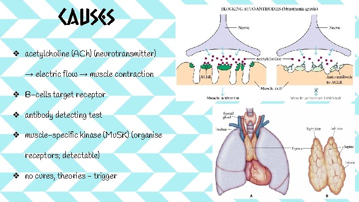 Causes ❖ acetylcholine (ACh) (neurotransmitter) → electric flow → muscle contraction ❖ B-cells target Causes ❖ acetylcholine (ACh) (neurotransmitter) → electric flow → muscle contraction ❖ B-cells target