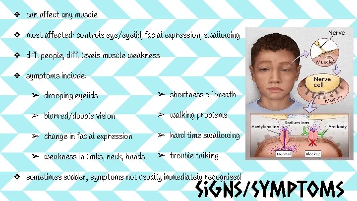 ❖ can affect any muscle ❖ most affected: controls eye/eyelid, facial expression, swallowing ❖ ❖ can affect any muscle ❖ most affected: controls eye/eyelid, facial expression, swallowing ❖