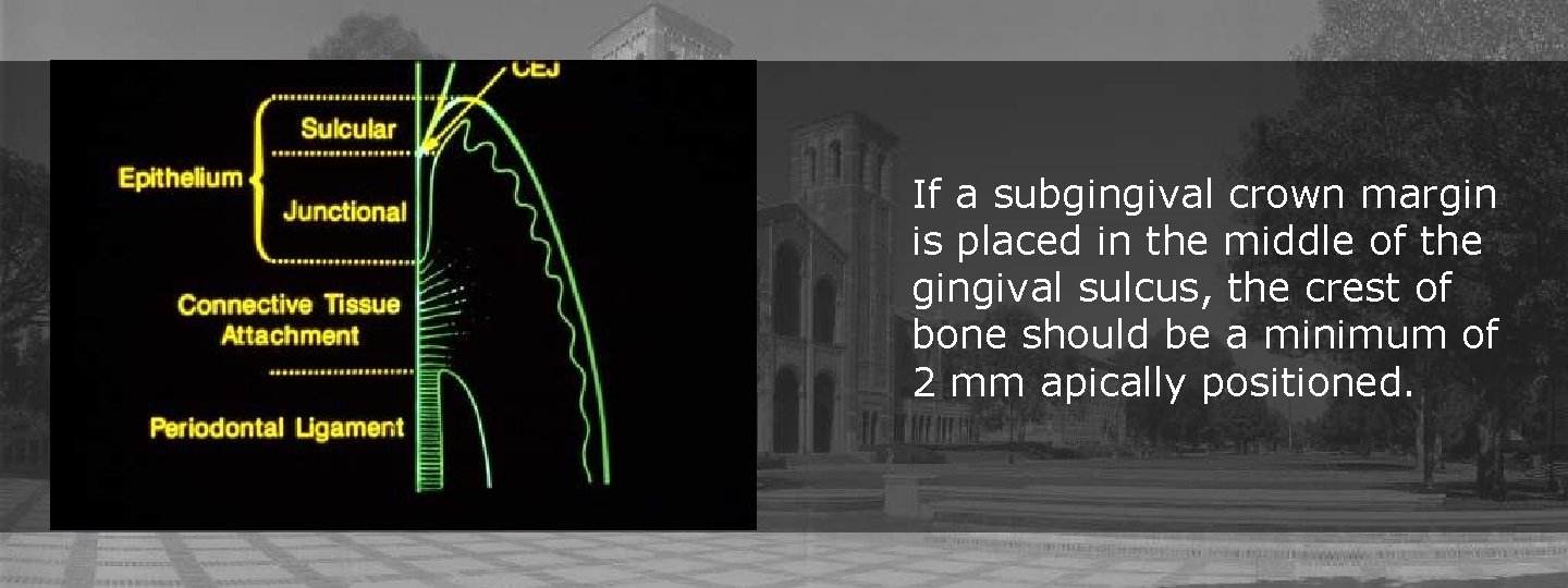 If a subgingival crown margin is placed in the middle of the gingival sulcus,