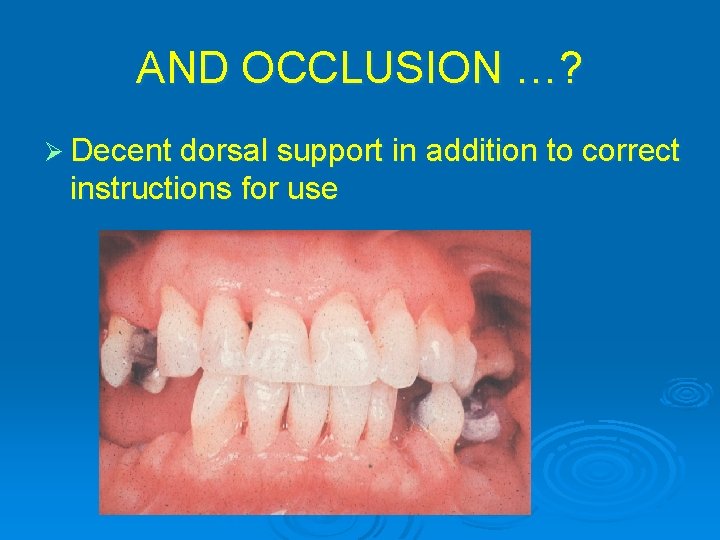 AND OCCLUSION …? Ø Decent dorsal support in addition to correct instructions for use