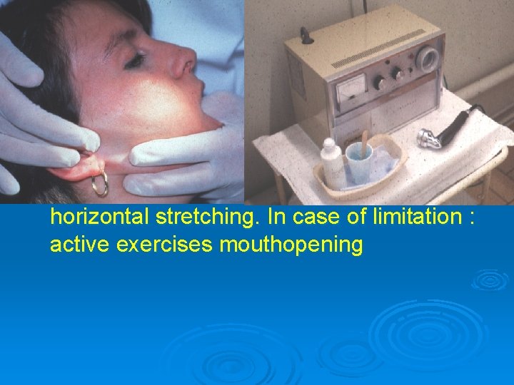 SPECIFIC THERAPY Ø 1. Myofascial pain with/without limitation : - INFORMATION - physical therapy