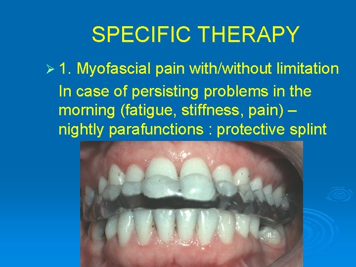 SPECIFIC THERAPY Ø 1. Myofascial pain with/without limitation In case of persisting problems in