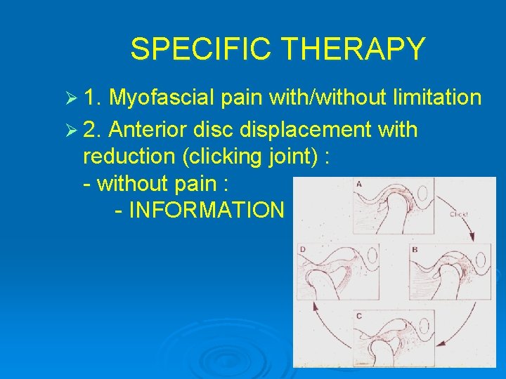 SPECIFIC THERAPY Ø 1. Myofascial pain with/without limitation Ø 2. Anterior disc displacement with