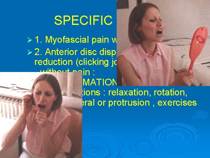 SPECIFIC THERAPY Ø 1. Myofascial pain with/without limitation Ø 2. Anterior disc displacement with