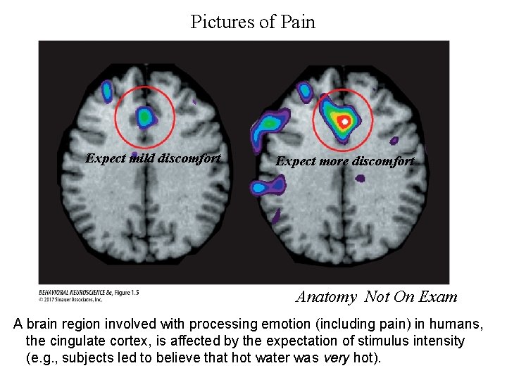 Pictures of Pain Expect mild discomfort Expect more discomfort Anatomy Not On Exam A