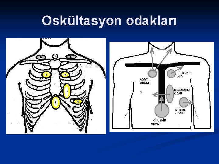 Oskültasyon odakları 