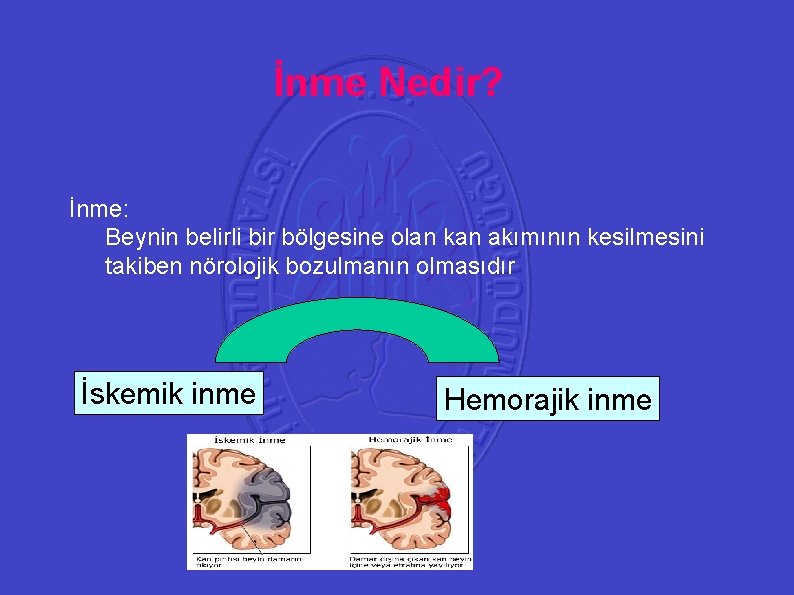 İnme Nedir? 41 İnme: Beynin belirli bir bölgesine olan kan akımının kesilmesini takiben nörolojik