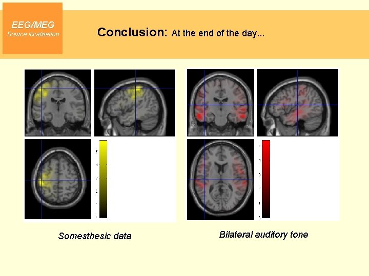 EEG/MEG Source localisation Conclusion: At the end of the day. . . Somesthesic data