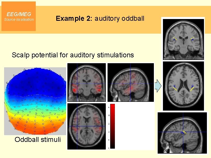 EEG/MEG Source localisation Example 2: auditory oddball Scalp potential for auditory stimulations Oddball stimuli